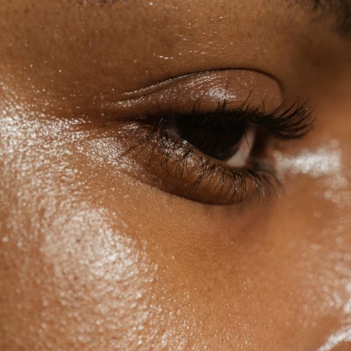 How to treat large pores