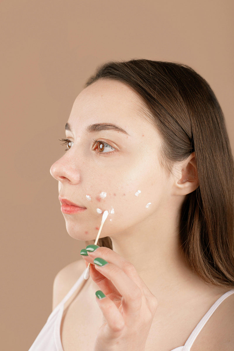 The Acne Myth: Why "Attacking" Your Breakouts Isn't Working