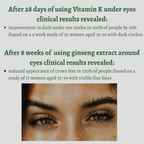 Best Eye Cream | Dark Circle Cream | Under Eye Cream | Dainty Skin
