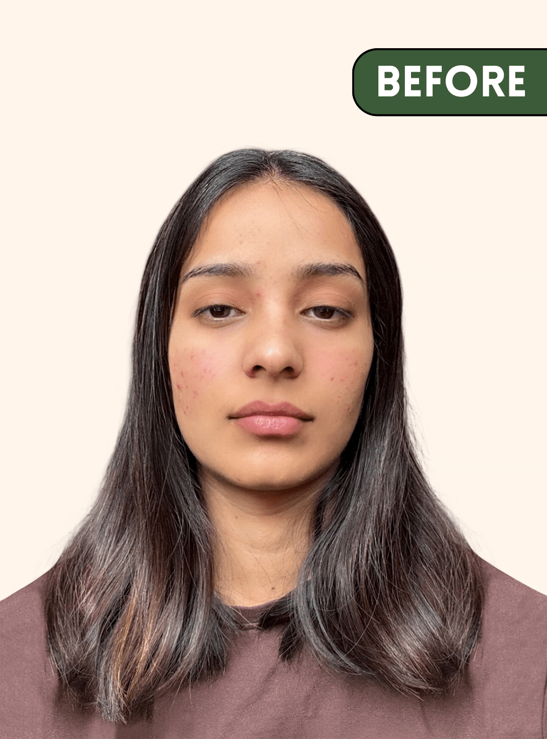 [product_title] - High Potency Botanical Skincare | [shop_name]